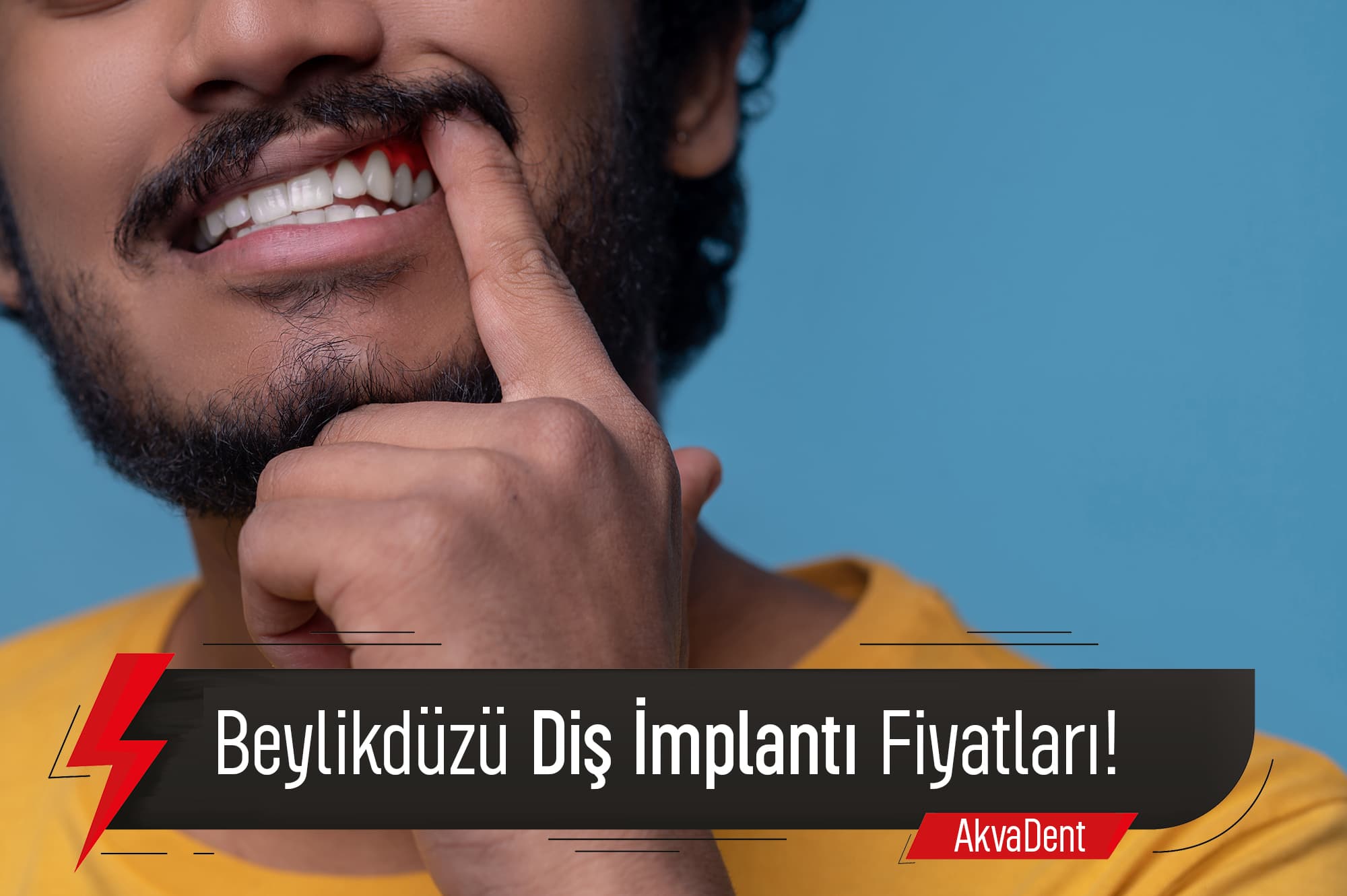 Her Bütçeye Uygun Beylikdüzü Diş İmplantı Fiyatları